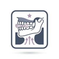 Performing the BRĒTH™ Procedure